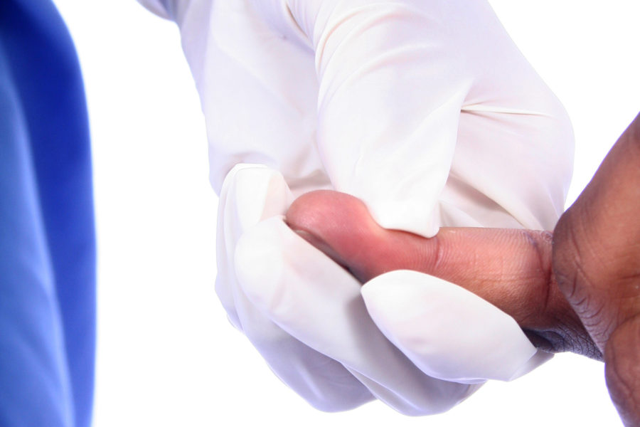finger prick for biometric screening